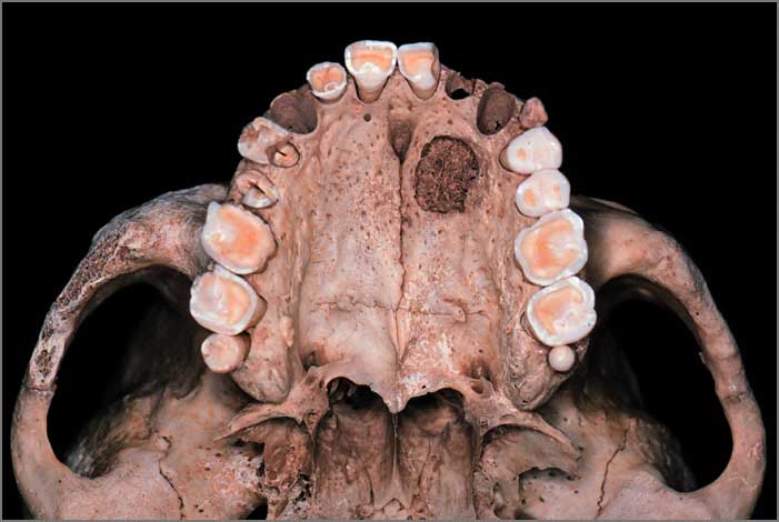 Upper palate of HRO 2